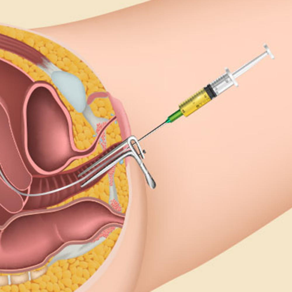 Gastrointestinal Cancer Treatment