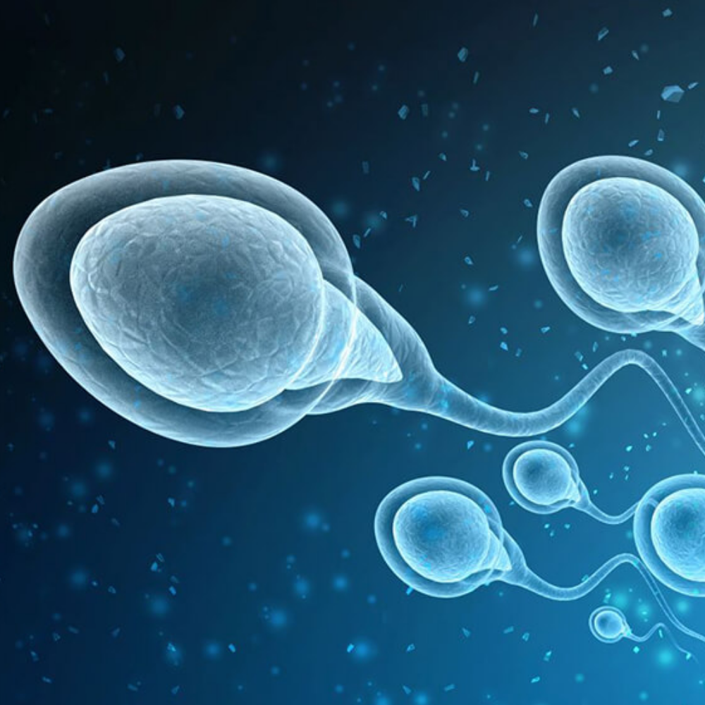 IVF with Donor Sperm