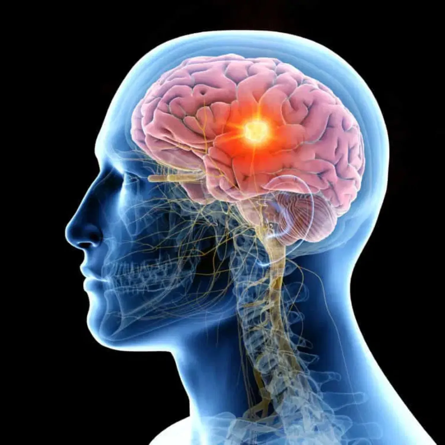 Brain Tumour Treatment