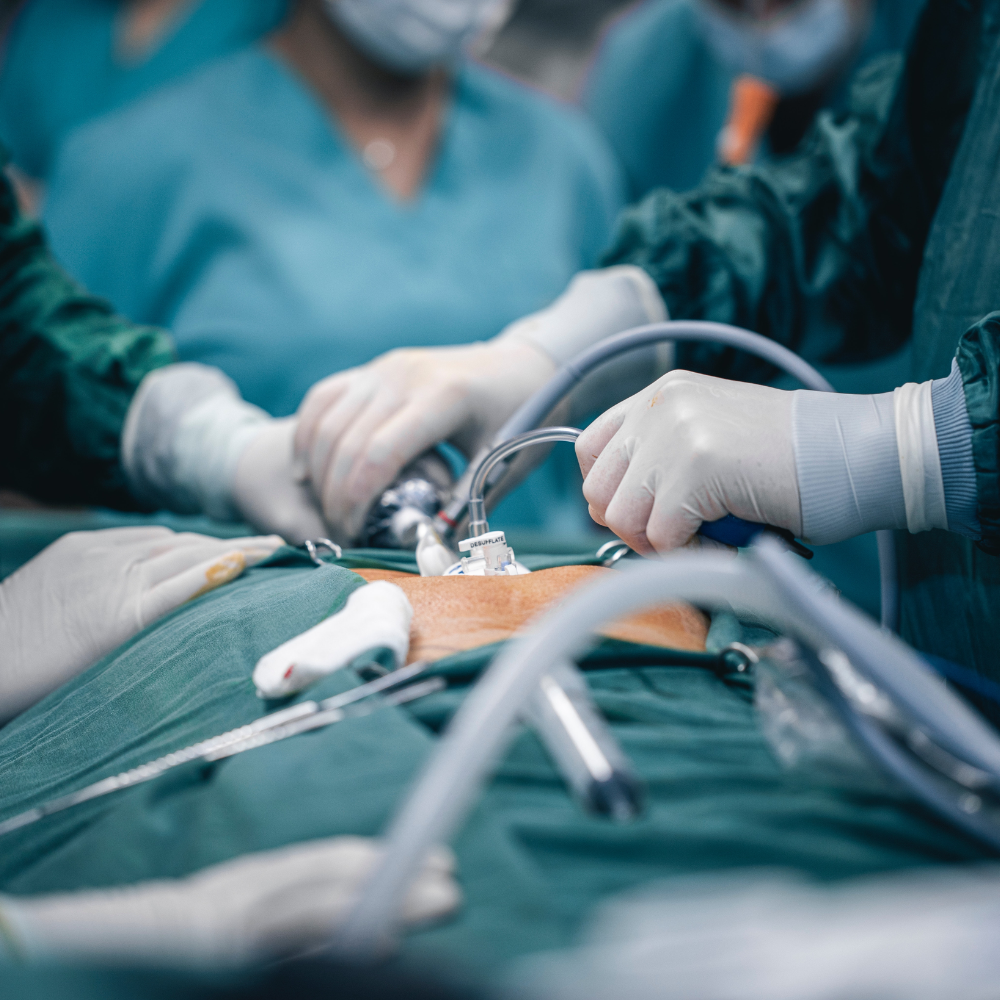 Abdominal Emergency Surgery